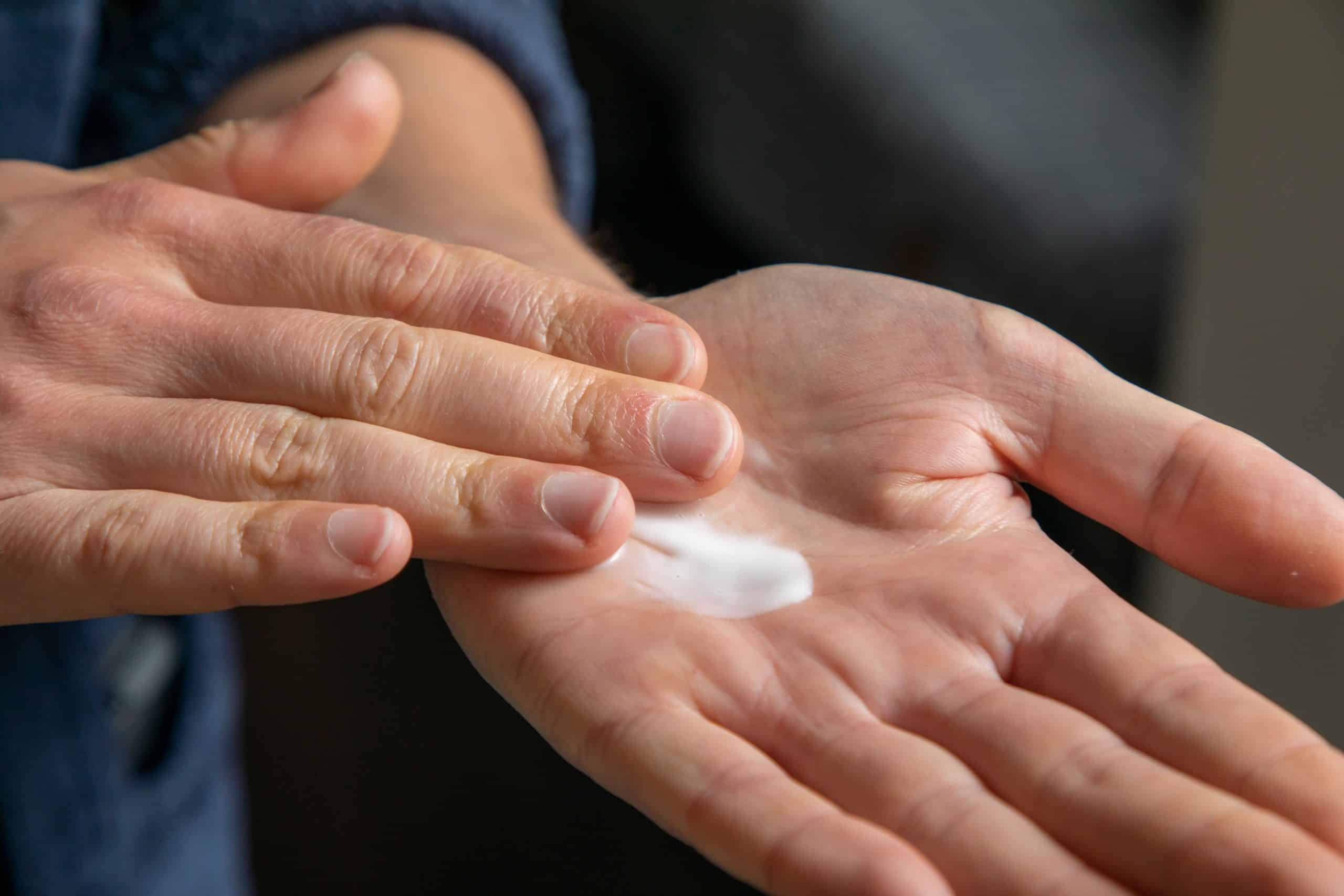 Close-up of lotion applied to a hand to protect skin during UV lamp curing